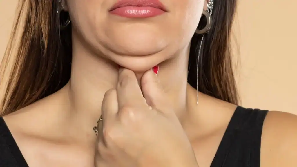 An image of a woman with double chin, sad, worried : Non Surgical Double Chin Removal Treatment in Lyndhurst, UK