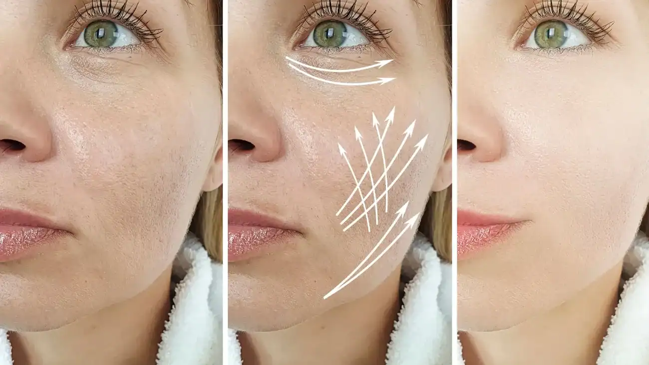 Can One Treatment Really Tackle More Than One Skin Concern Lyndhurst?