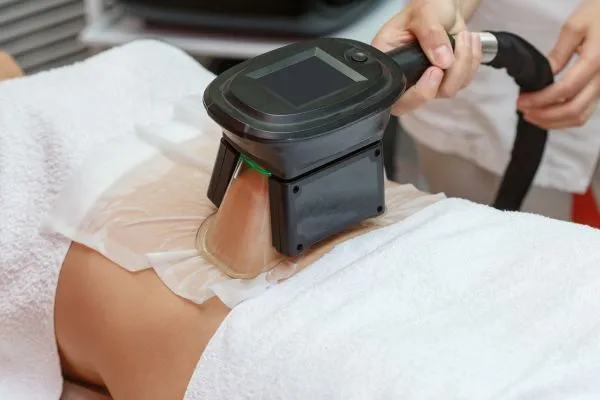 Image of person having fat freezing treatment to help weight gain Lyndhurst