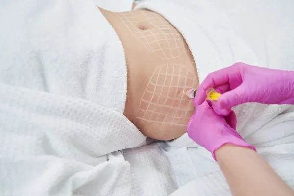 image of fat dissolving injections on love handles to help combat weight gain Lyndhurst