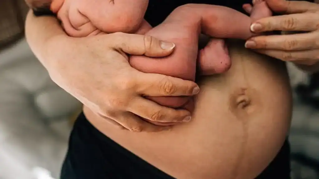 Why Is My Stomach Still Big After Pregnancy Lyndhurst?